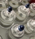 Vacuum Cupping Set thumbnail